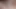 Close up of limp banded cock masturbation until cum or orgasm contractions, tight banding with hose clamp