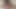 Clit Pumping And Orgasm For Fat Hairy Cunt