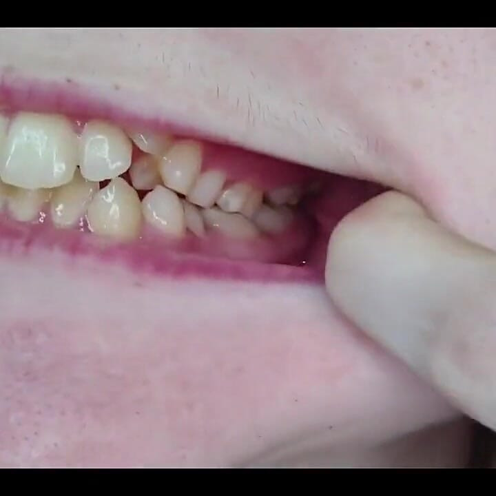 Mi boca, dientes, lengua y garganta de cerca