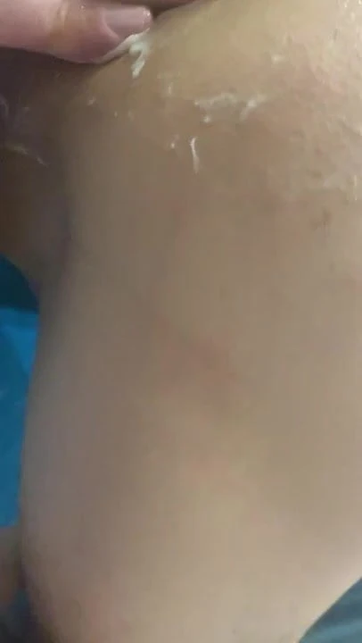Fisting