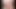 Pakistani Desi Gay boy fingered himself and found anal fissure after Fingering