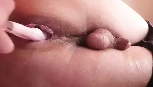 Anal orgazmus