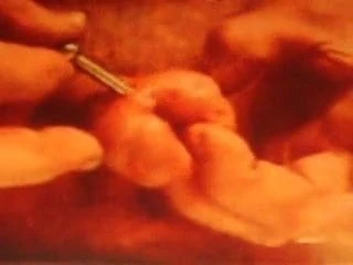 penis