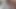 lizzy yum VR July 2023 JUST one black dildo Post-op Orgasm Pussy Clit Masturbation Teasing Orgasm