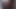 Vagina Contractions Masturbation Pussy Speculum Wide Gaping