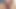 Schamlippenspreizer