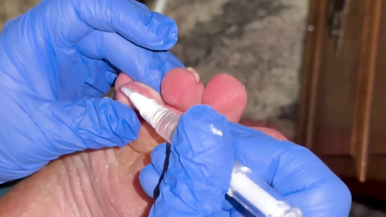 Crusty Foot Care and Worship - FTM