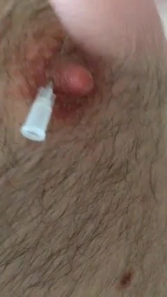 Ab durch die Brust! Aua! 5