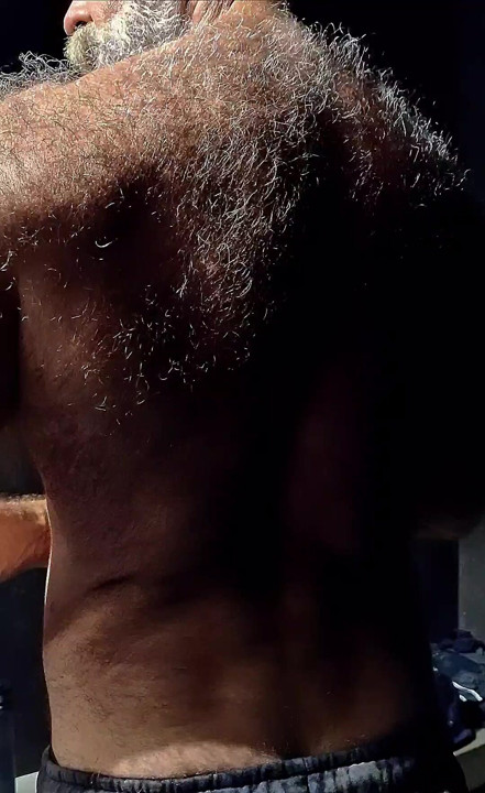 my HAIRY BACK