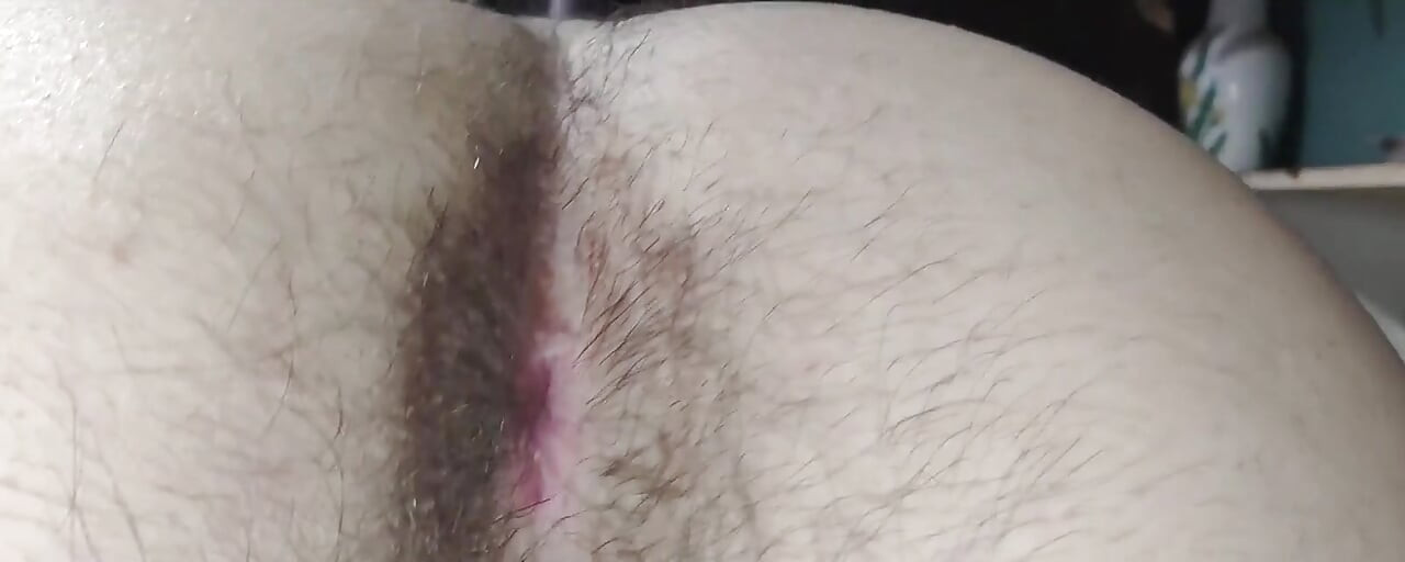 An Extreme Close-up of a Super Hairy Butt. I Haven't Cleaned Myself up Very Well, It Seems