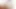 Kylie İrlanda teaser 3