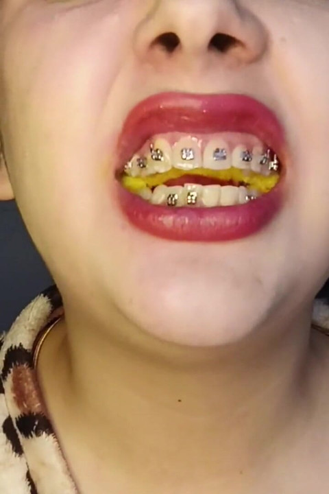 Chew Cheetos POV Uvula
