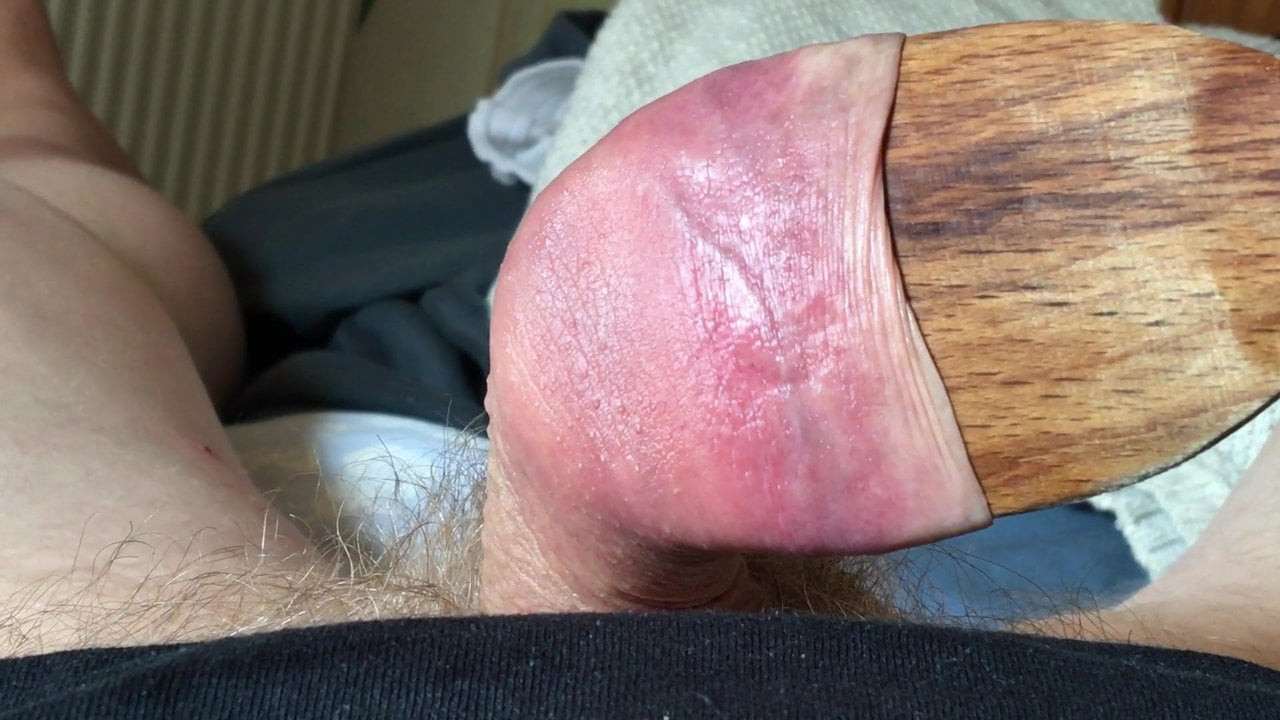 Spoon in foreskin