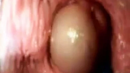 vagina di dalam