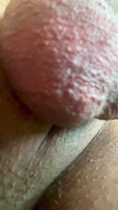 Powerful erection