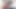Foreskin one-hour video