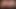 Hairy Cock In Sexy Underwear (Episode 3 - Now With Better Image Quality)