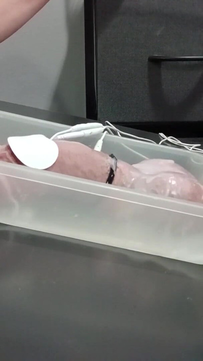 来自“蜡和 2b estim 射液”的迷人时刻