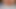 Nudist 12 mm Prinzenzepter im  Pissloch und anal Prolapse