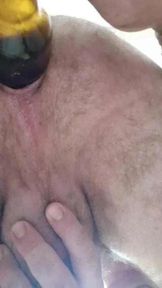 anal