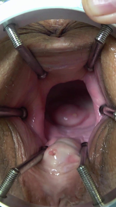 What's Inside of Me