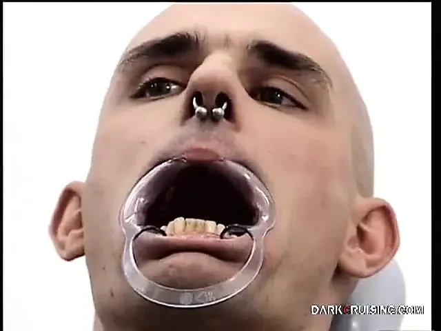 Trapped in the dentist chair