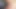 Complications of semen coming out in the pussy