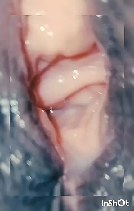AfricanSuperTeen Live DeepPussy 🍑 Cumshot