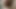 A young boy is masturbating and is in pain.