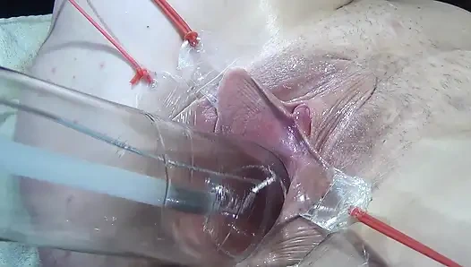 10 Weit Gespreizte Muschi Nahaufnahme Fickt Mit Lampe 1000 Watt