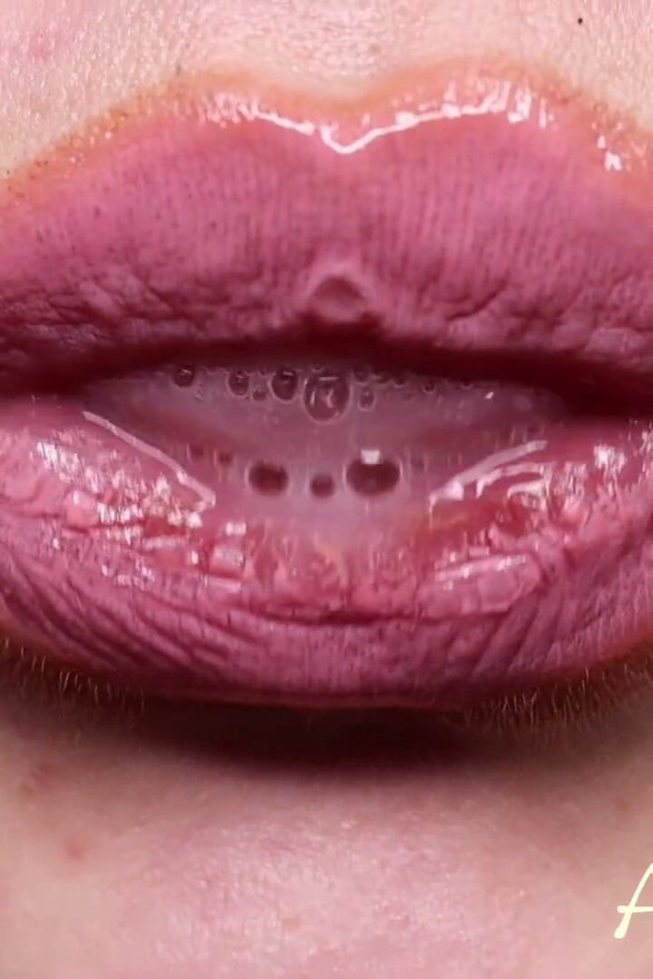 Clog in My Saliva Creature
