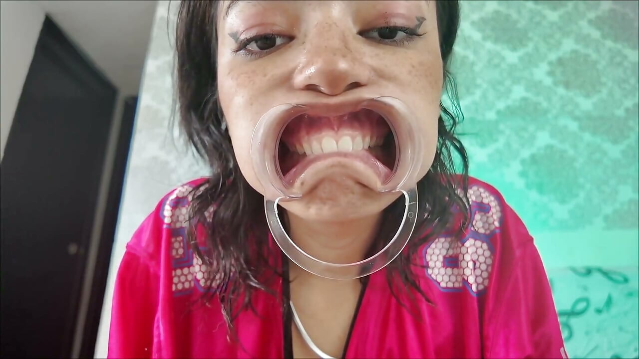 Cheeks Pulled Apart Teeth Exposed