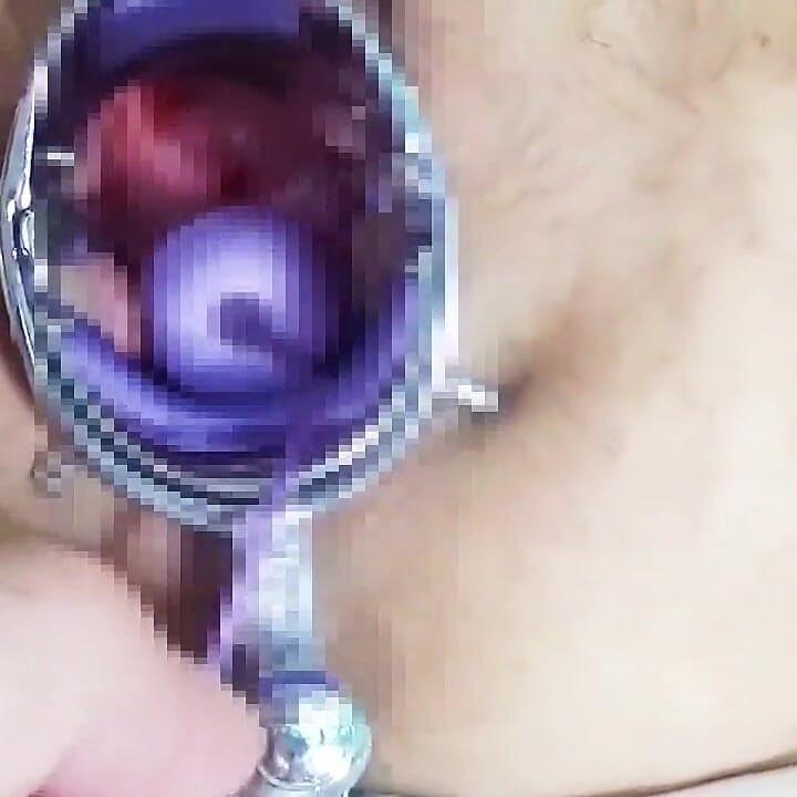 Using a Speculum to Spread an M-woman's Pussy, Anal Training　1/2
