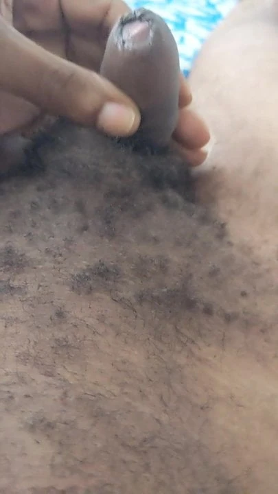 Tip of the head