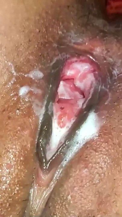 Tinny Neha  in pussy cumshot and condam fucking | Clip 1