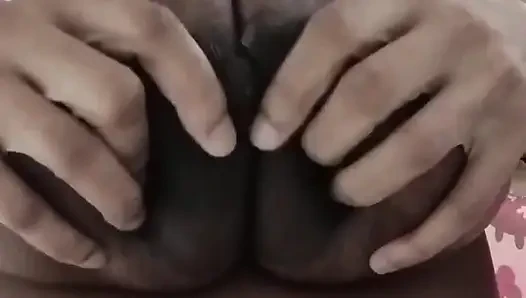 Engorged