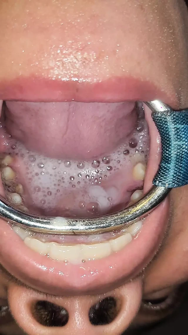 Throat Fuck with Open Mouth Gag and Spit Cum in Mouth
