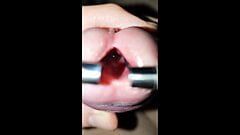 L'uretra giovane si allunga al massimo, guarda dentro e dilatatore di 10 mm dentro