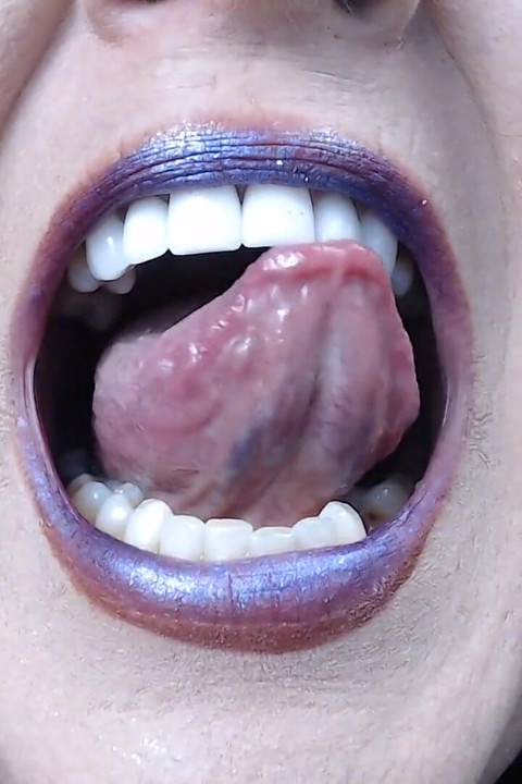 Deep Inside Tongue Teeth Uvula Throat
