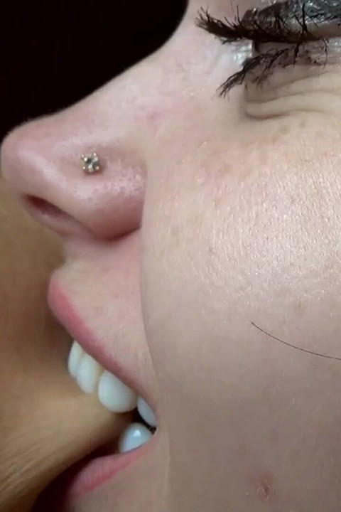 Hard biting of male fingers and arm
