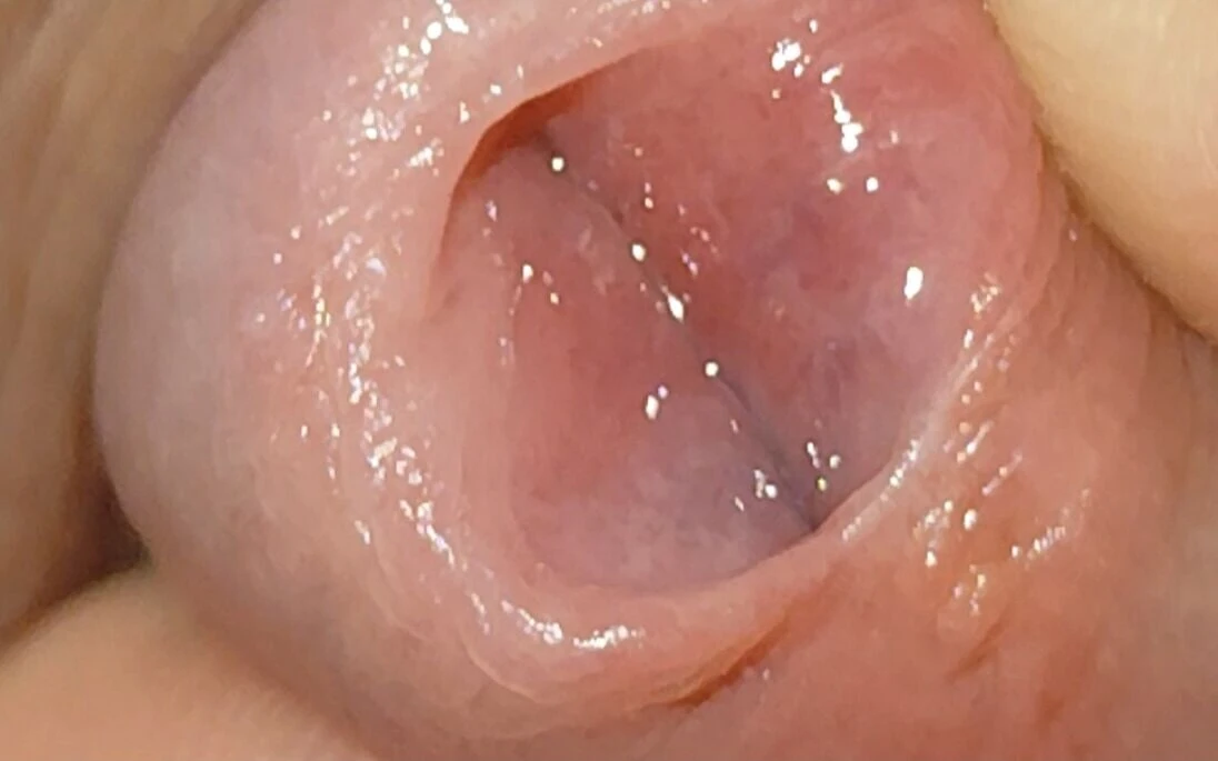 Nonno etero che sala il glande con sale iodato.