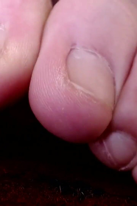 Long Toes No Nail Polish