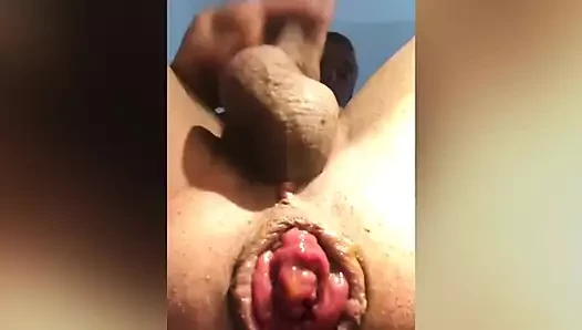 Entracte porn video – entracte dilatation anal