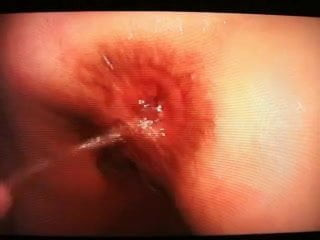 anal squirt