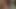 Acıttığını biliyorum bebeğim!