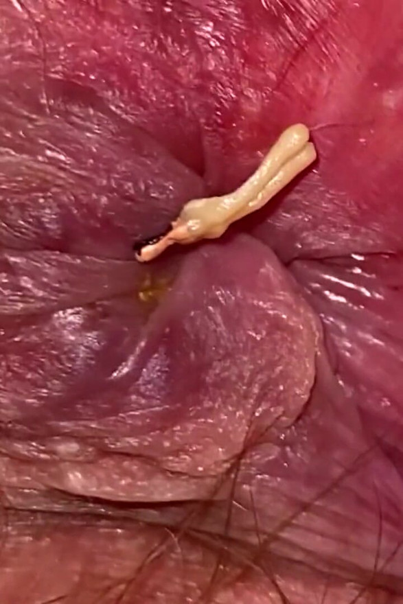 Giantess fetish video hairy asshole extreme closeup