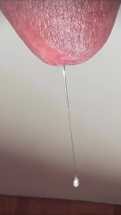 Penis Dripping