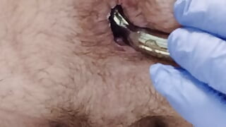 Stretching hole