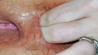 HUSBAND AND WIFE TOYING HAIRY ASSHOLE