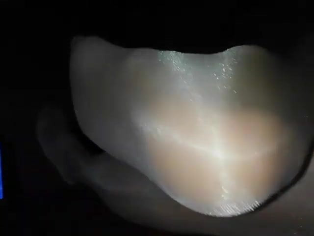 Nylon 87